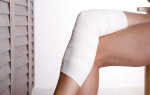 Varice în picioare: simptome și tratament