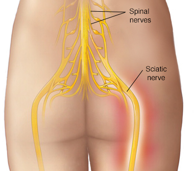 dureri de spate inferioare articulații pelvine sciatic