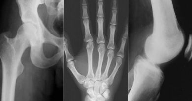 Radiografiile sînt necesare în diagnosticare